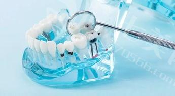 刷新济南口腔医院牙齿美白要多少钱 超声波洗牙300/3D锆齿美白100元起