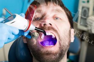 速览宁波口腔医院牙周治疗价格一览表 牙周炎治疗200起可网站挂号预约哟