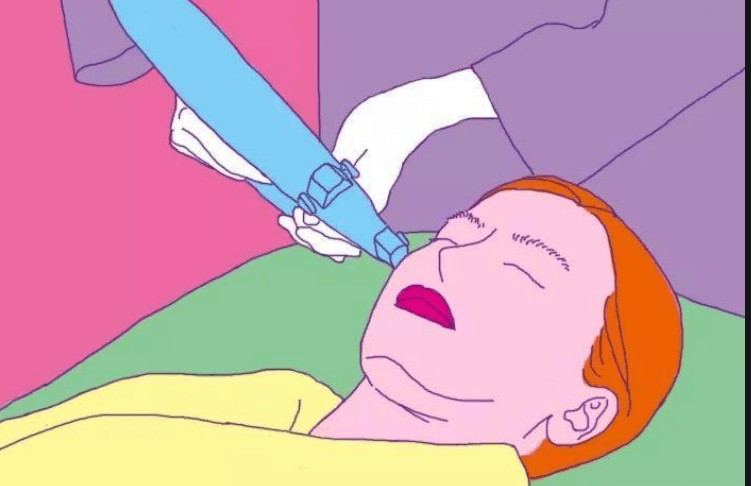做抬头纹不用怕,去前体验这个奇效项目