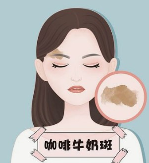 做开外眼角后眼神变迷人了?