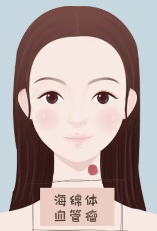 做完开外眼角后，你的眼睛会有怎样惊人的变化？