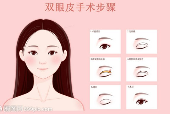 眼袋一步去除省时省力做外切手术过程安全无痛