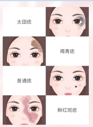 做完垫下巴后，这些意想不到的变化让人惊喜