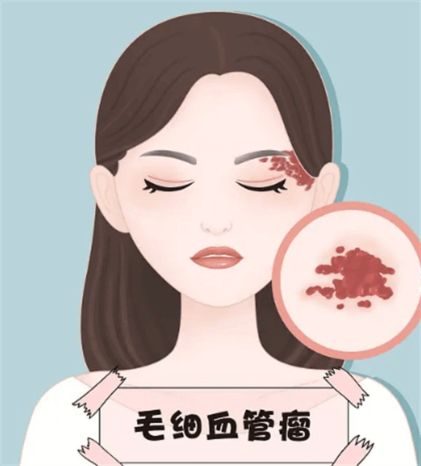 做热玛吉前需要了解哪些注意事项才能保证效果和安全？