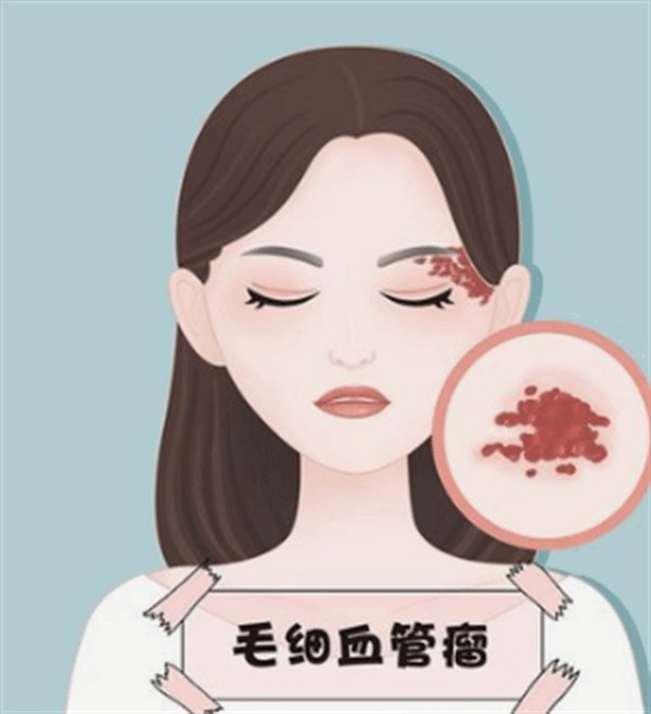 做黄金微针前需了解哪些重要信息?