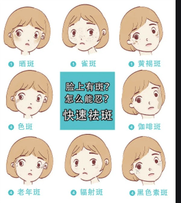 眼袋一步去除省时省力做外切手术过程安全无痛