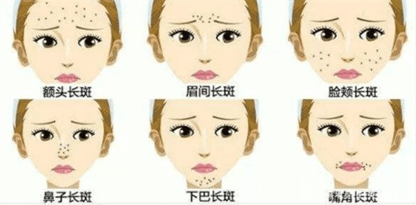做完美容去雀斑前，如何有效防止肌肤受损？