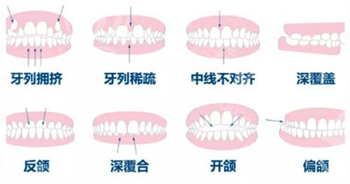 苏州昆山口腔医院排行榜
