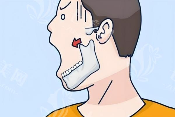 下颌角磨骨哦1.jpg
