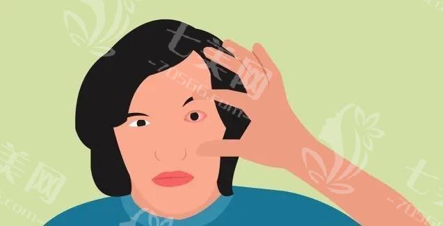 重庆双焦点散光晶体7大排名榜已上线 这些均是正规眼科医院价格不贵