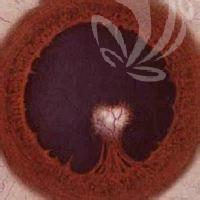 郑州蔡司飞秒A+哪家正规又靠谱？ 郑州蔡司飞秒A+性价比高的医院在此