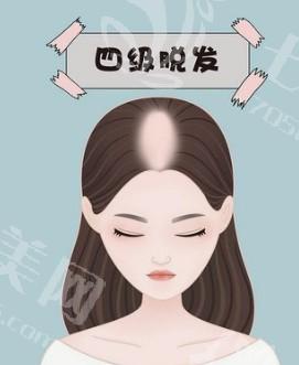 做好祛疤的过程，轻松摆脱肌肤烦恼，重拾自信美丽秘诀！