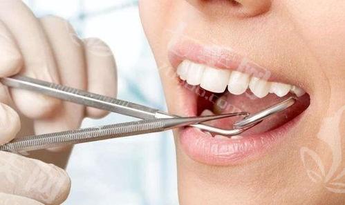 瞅瞅上海口腔医院牙齿矫正收费价格 在口腔医院做成人正畸12000