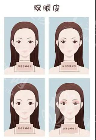 亲测告诉你做去鼻唇沟前需知道的四大注意事项