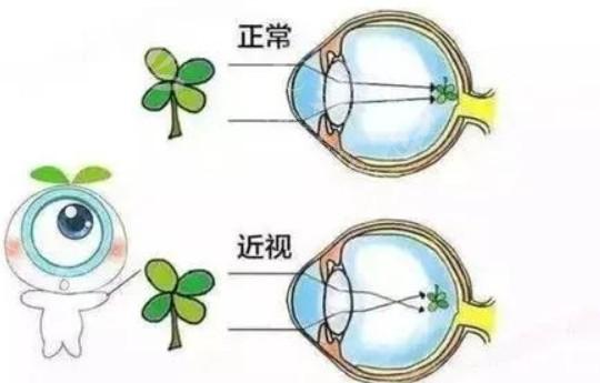 合肥微小切口非球面折叠晶体哪里做得好又比较正规? 东南/沃瑞/华厦均在榜单