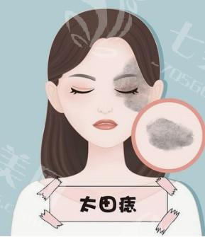 做祛疤前，你需要了解的五大关键知识，帮助你有效改善肌肤问题！