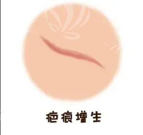 丰耳垂三步做好,过程简单方便有保障 丰耳垂三步做好,过程简单方便有保障