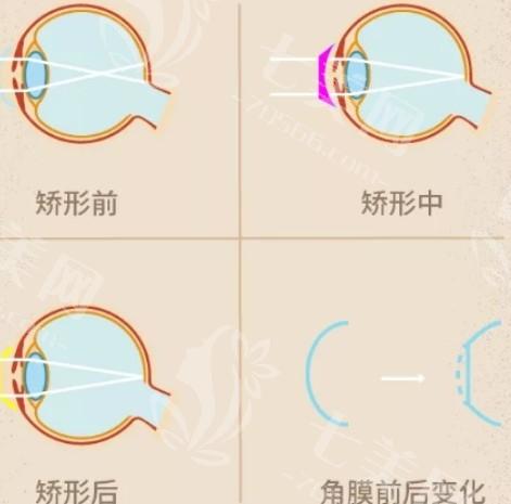 武汉半飞秒激光有名的眼科医院排名 排名上悦瞳/普瑞/爱尔挺出名