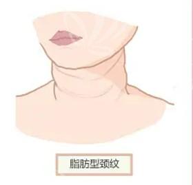 东莞黄金微针哪家正规又靠谱？ 东莞黄金微针性价比高的医院在此