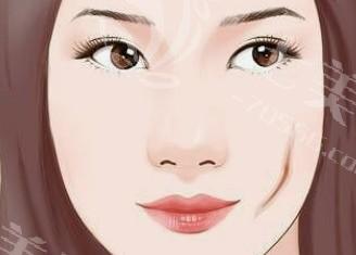 做哪些准备去鼻唇沟前，才能让你轻松拥有年轻无暇的面容？