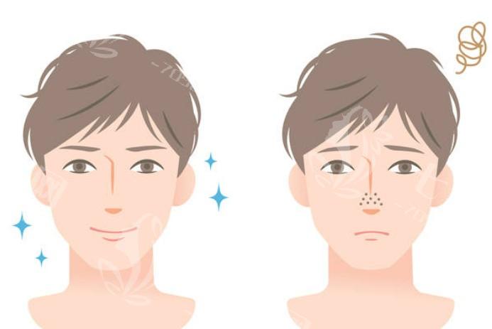 做地包天矫正过程需要多久？详细步骤解析让你更清楚！