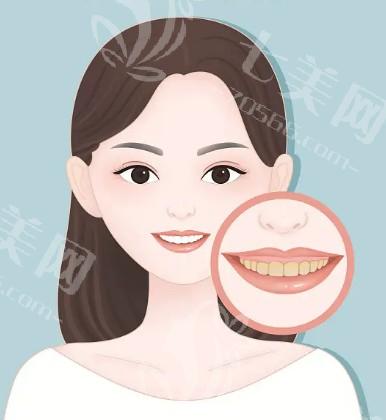 长沙冷冻溶脂瘦小腿哪个医院可以做 协雅/如美/宸美技术都不错！