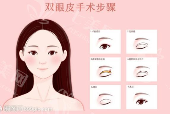 天津开内眼角好又便宜的医院名单 这几家口碑好网友都认可