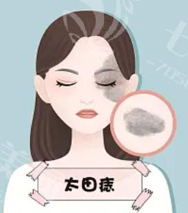 揭晓合肥整形医院毛发种植价格一览表 做种睫毛1500/种眉毛3000挺便宜