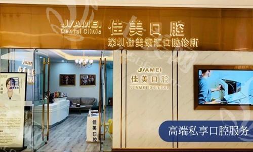 深圳儿童窝沟封闭好的口腔医院排名 佳乐/迈兔/深圳佳美口腔顾客多,地址也好找