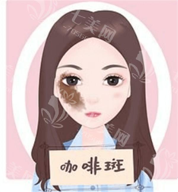 做一次去雀斑的治疗，后续效果如何？真能让肌肤焕然一新吗？