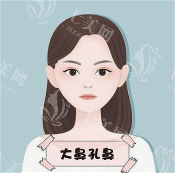 武汉玻尿酸丰太阳穴医院排名前8 上榜的口碑也不错