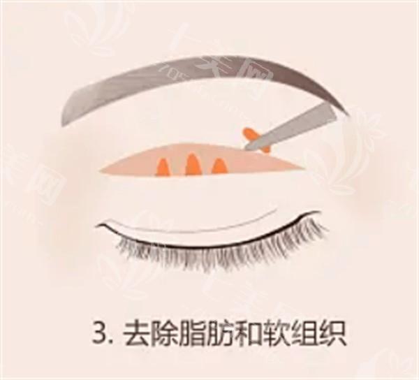 丰卧蚕做在前,嫩白肌肤只几步?