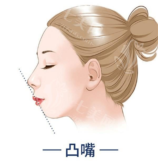 做眼部整形后，怎样保持效果更持久？这几点你必须知道！