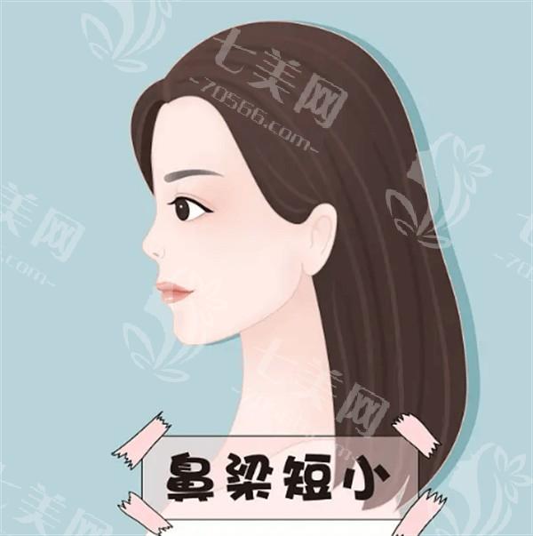 做自体脂肪丰苹果肌过程中要注意哪些事项?