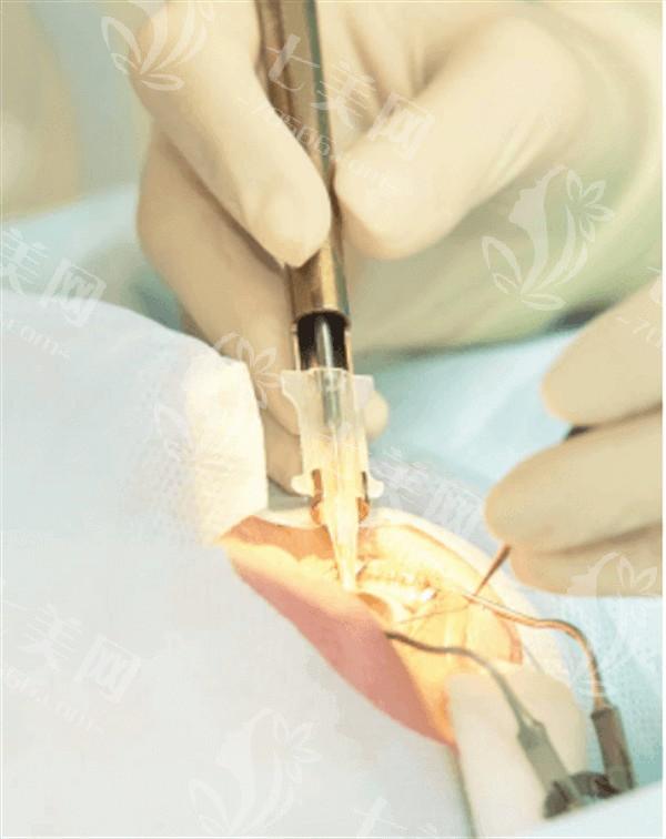 广州英华儿童眼科门诊部正规吗？从医生团队 / 收费价格表分析是否靠谱