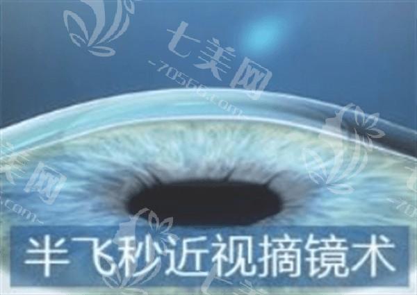杭州个性化准分子有名的眼科医院名单公布  一并看看杭州哪家医院好