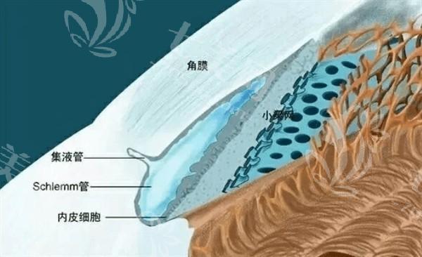 石家庄T-ICL晶体植入排名前5名单 收费实惠口碑好的看这几家