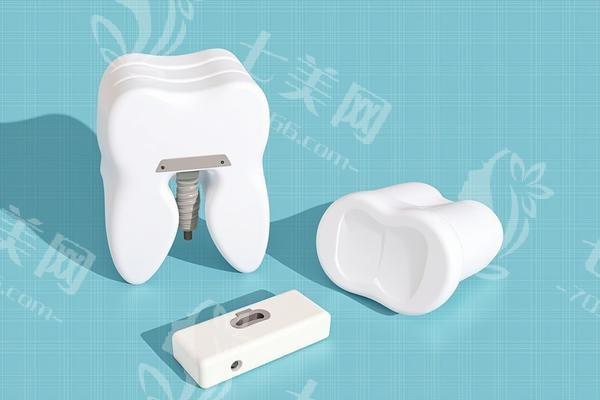 速览广州牙科的医院补牙收费贵吗 含龋齿|玻璃电荷补牙|3M树脂充填|楔状缺损充填价格