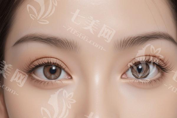 郑州个性化老视有名的眼科医院排名 郑州尖峰眼科、郑州华厦视光眼科医院、郑州博爱眼科列居前三
