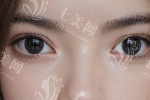 合肥做双眼皮技术好的整形医院推荐：壹加壹/维多丽亚/华美口碑好