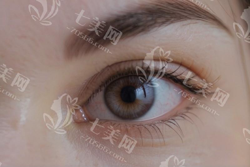 郑州博爱眼科医院正规吗？从儿童眼病诊疗特色项目看实力