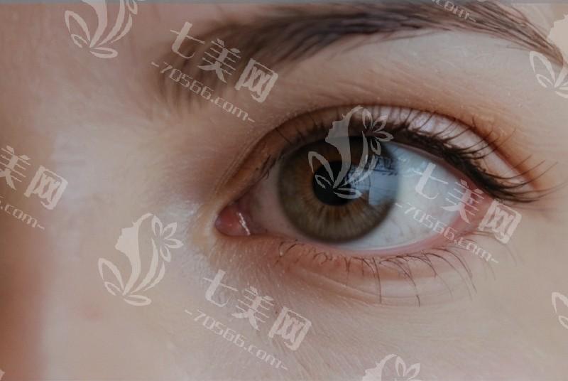 儿童视力问题频发，警惕黄斑病变，ICL 手术与护眼计划不可少