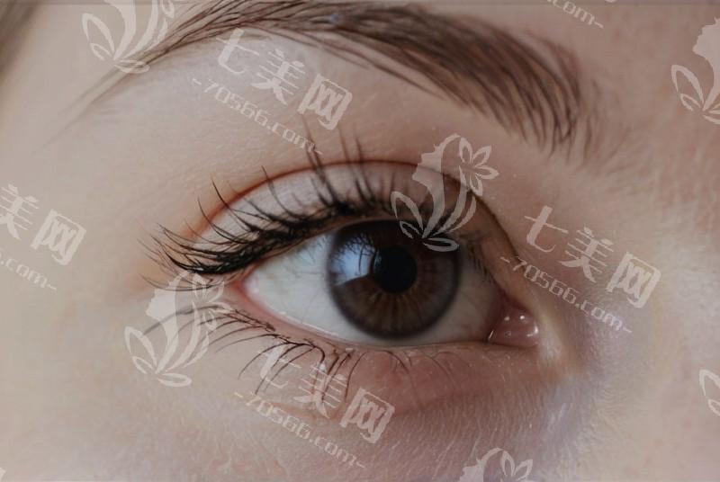 儿童视力问题频发，警惕黄斑病变，ICL 手术与护眼计划不可少
