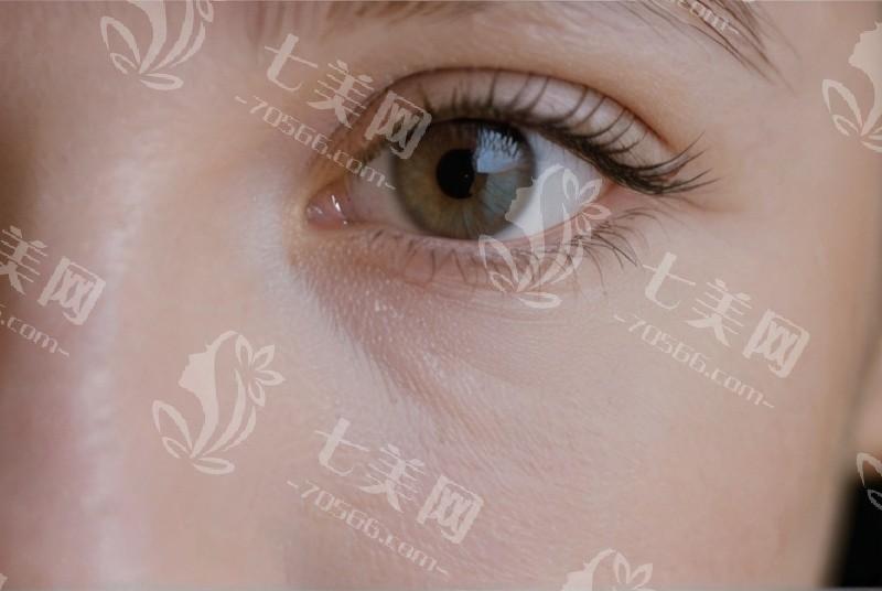 想要预防近视眼，这些小窍门你掌握了吗？眼睛保护还有啥要点？