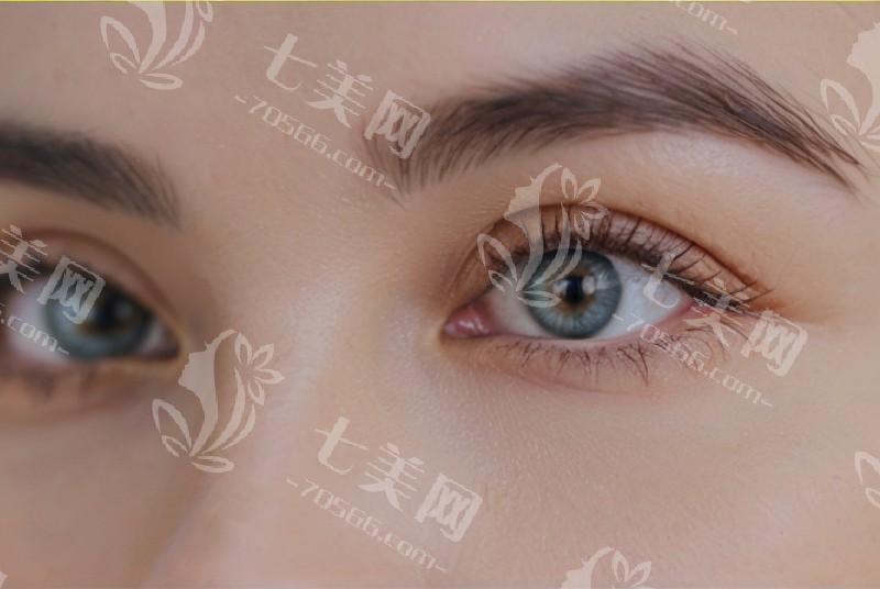 上班族总干眼，咋通过日常护理来缓解？
