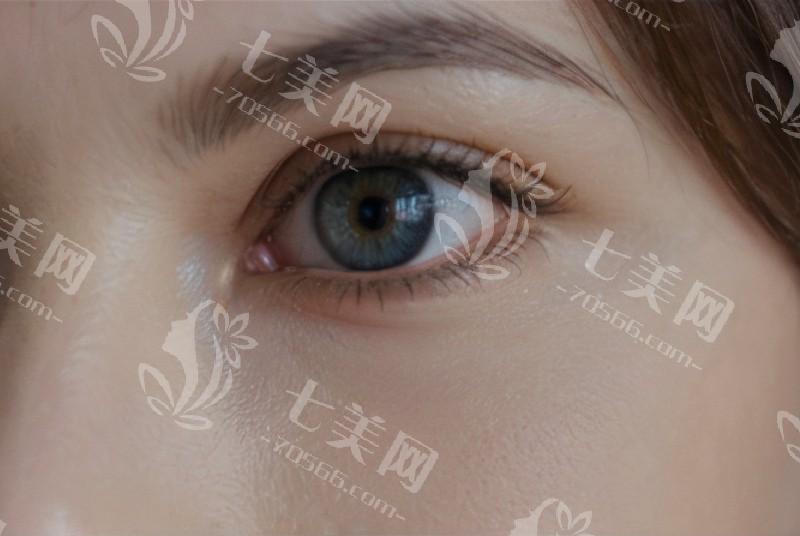 上班族总干眼，咋通过日常护理来缓解？