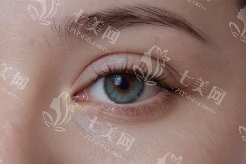 阳泉爱维视医疗收费价目表揭秘，这里的眼科治疗价格很合理