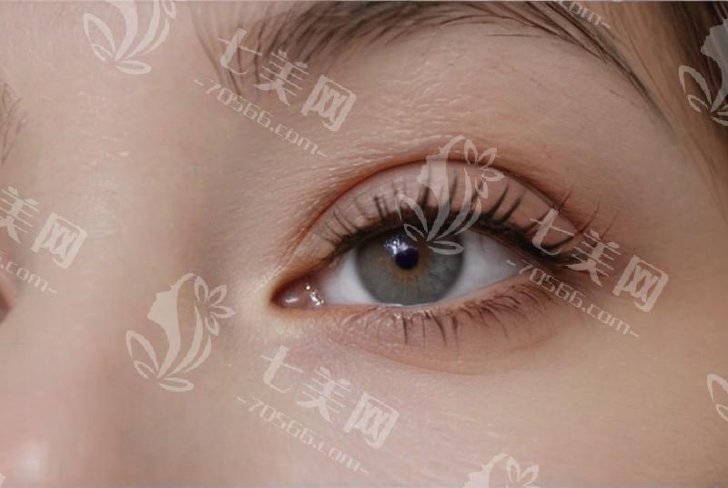 嘉兴朝聚眼科医院价格表？散光晶体 / 非球面折叠晶体 / 单焦点晶体收费合理