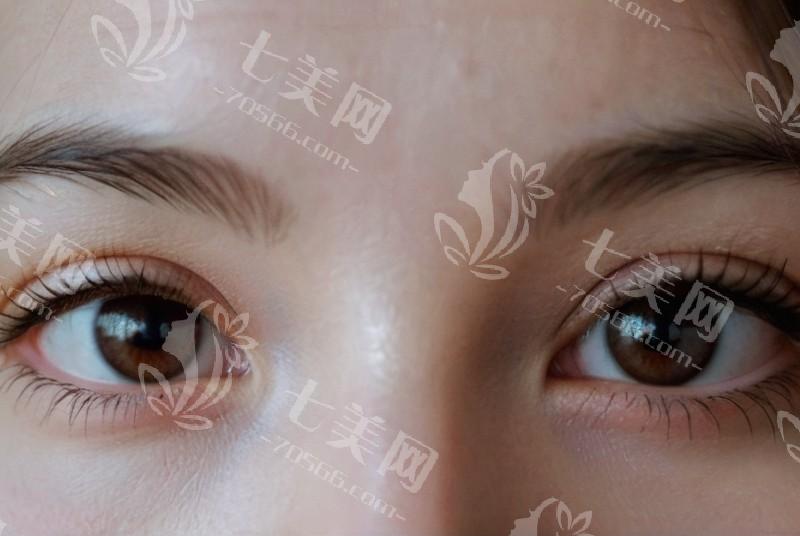 杭州飞秒秒眼科青光眼手术收费贵吗？收费透明且医生技术牛