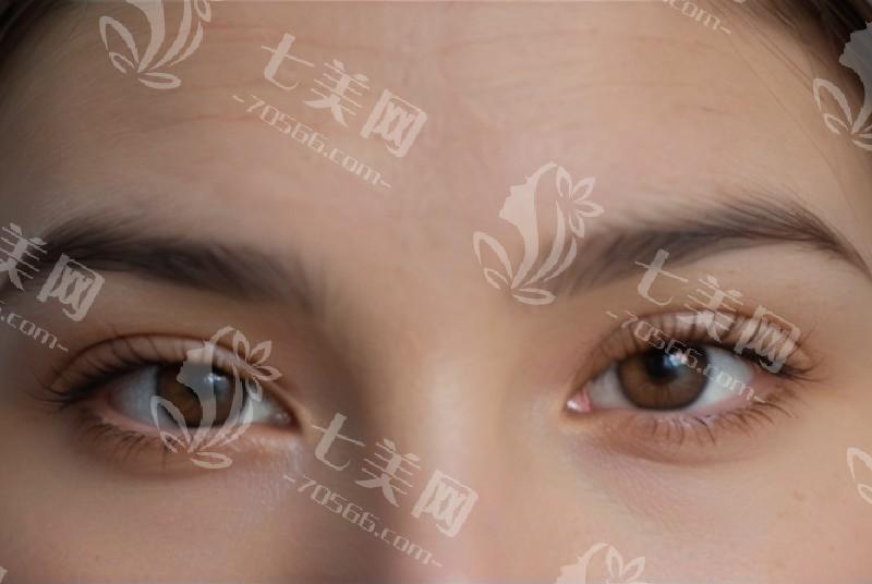 青岛眼科手术后续服务哪家好？复查安排及时周到问题解答清晰到位关怀体系完善